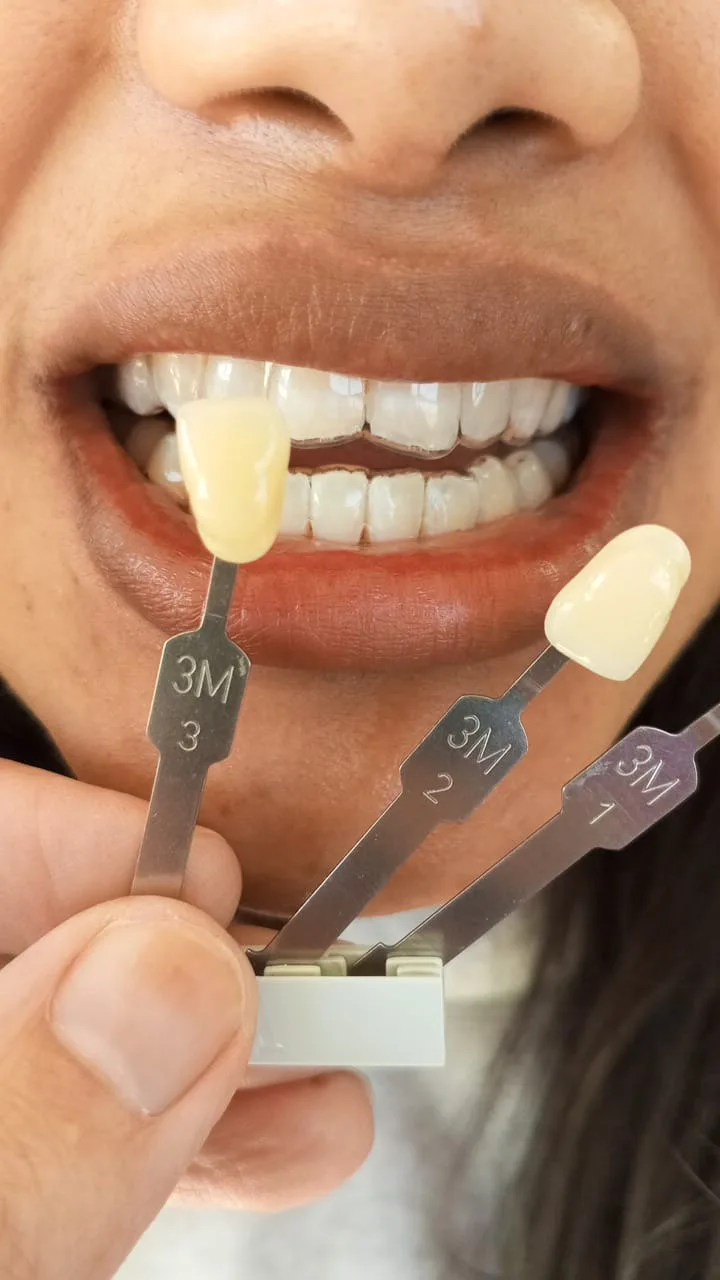 3M shade guide used for treatment planning